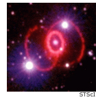 SN 1987A